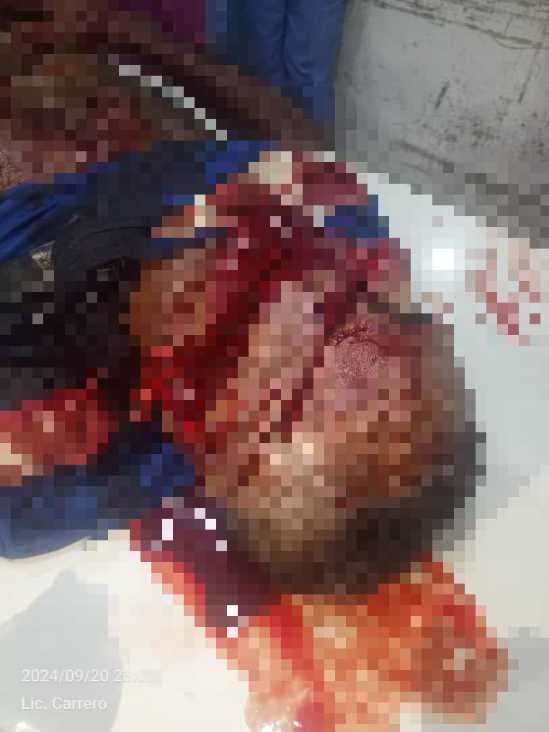 1000879315